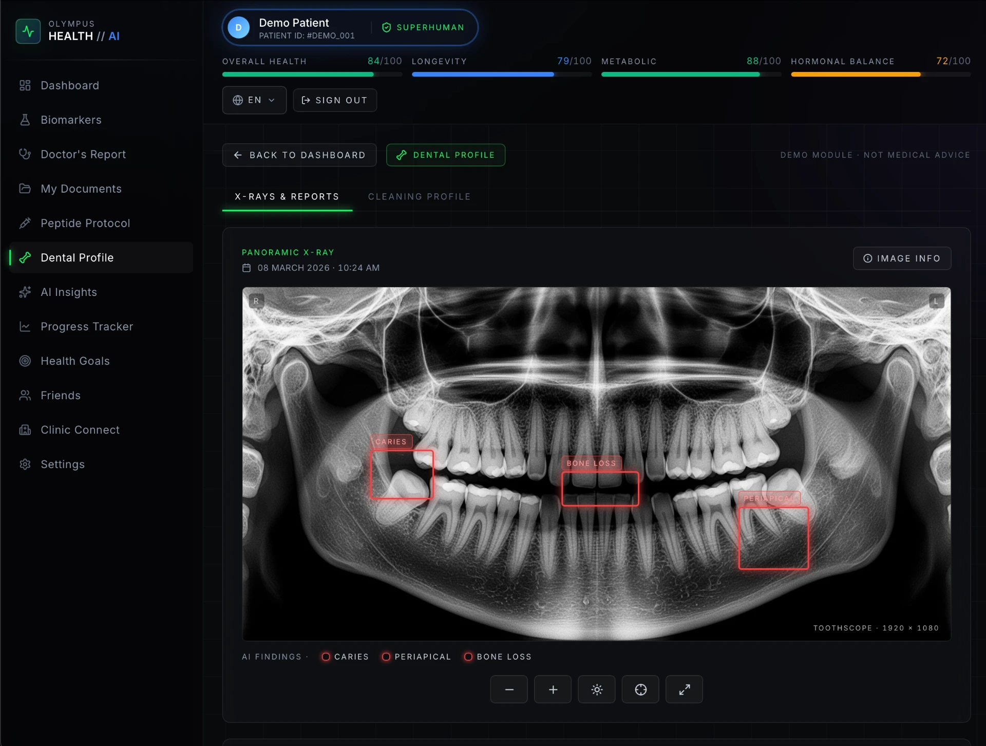 Olympus Health AI — dental profile x-ray analysis